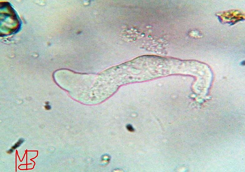 Amoeba stellata metamorfosi